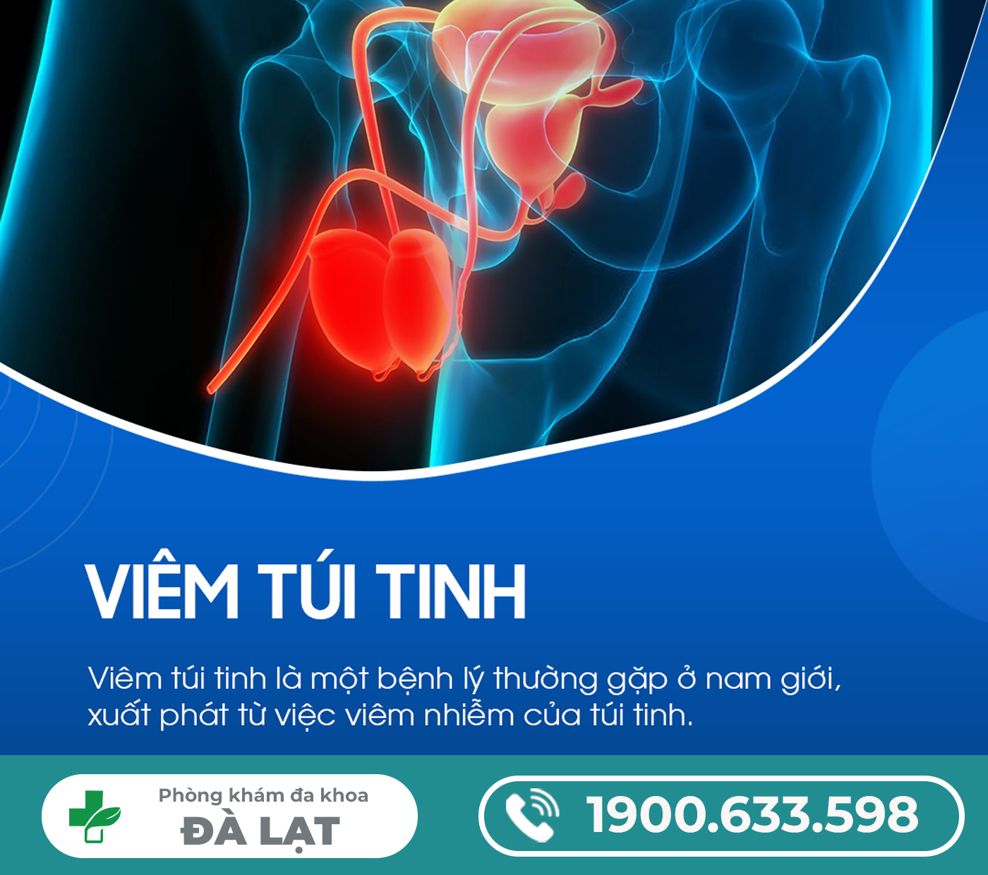 NGUYÊN NHÂN GÂY VIÊM TÚI TINH